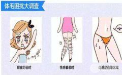 彩光脱毛副作用?彩光脱毛有副作用吗?