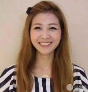 法令纹怎样消除?玻尿酸去除法令纹案例分享~ 法令纹怎样消除?玻尿酸去除法令纹案例分享~