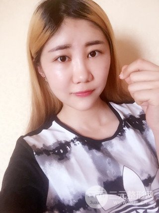 深圳臻希美详细部自体脂肪填充果对比超明X