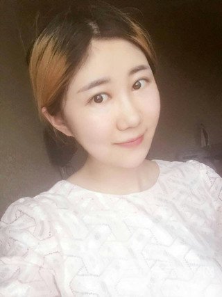 深圳臻希美详细部自体脂肪填充果对比超明X