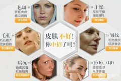 光子嫩肤一般做几次才有果