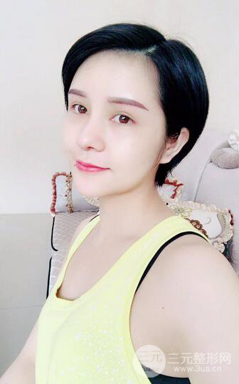 做了隆鼻整形隆鼻之后，短发女孩也可以性感！
