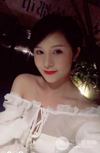 做了隆鼻整形隆鼻之后，短发女孩也可以性感！