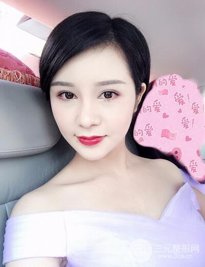 做了隆鼻整形隆鼻之后，短发女孩也可以性感！