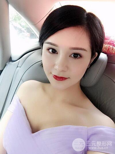 做了隆鼻整形隆鼻之后，短发女孩也可以性感！