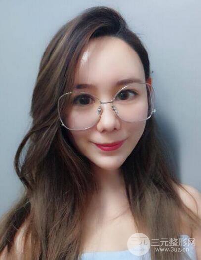 全脸自体脂肪填充,填充不饱满还可以瘦脸_真人案例