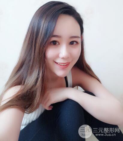 全脸自体脂肪填充,填充不饱满还可以瘦脸_真人案例