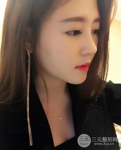 膨体隆鼻术后恢复果图_全过程解密
