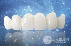 烤瓷牙价格和种类