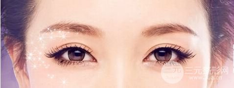 北京韩式微创开眼角多少钱、开眼角前后对比照片