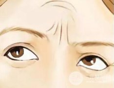 去除眉间皱纹?眉间有皱纹怎么办? 去除眉间皱纹?眉间有皱纹怎么办?