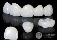 烤瓷牙种类及优缺点有哪些？