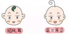 招风耳好不好？耳畸形整形哪些医生技术好？