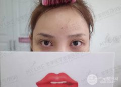 绣眉需要多少钱？绣眉后1至7天变化图片分享~