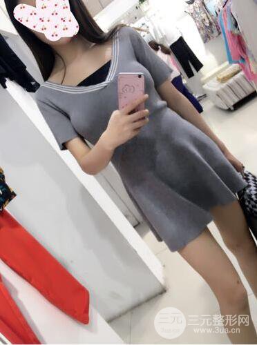 无锡丽都陈广平假体隆胸案例