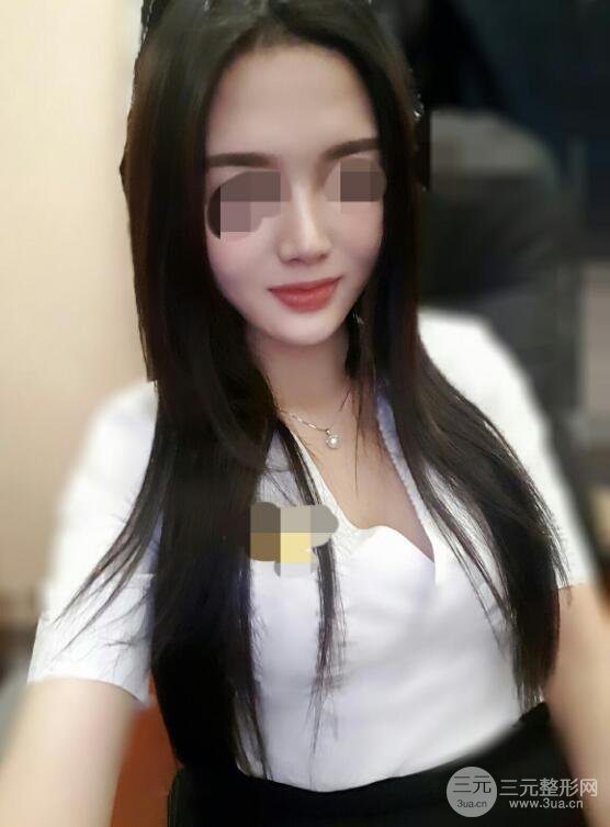 无锡丽都陈广平假体隆胸案例