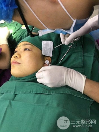 辛敏强隆鼻整形真实案例果对比照片分享