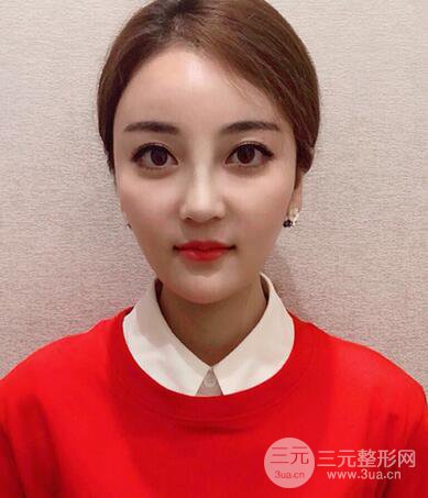 自体脂肪填充详细部过程分享|不用磨骨也可以小脸