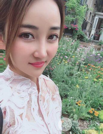 自体脂肪填充详细部过程分享|不用磨骨也可以小脸