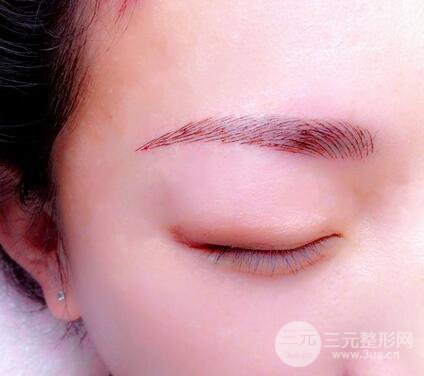 洗眉要多少钱？激光洗眉多少钱？