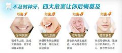 镶牙种类都有哪几种呢