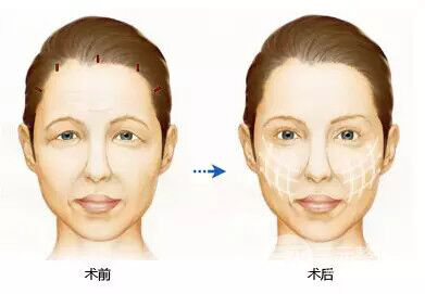 深圳科美丽格整形医院价格表正规推荐一览