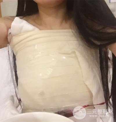 假体隆胸手术恢复记录，丰满大胸不是梦