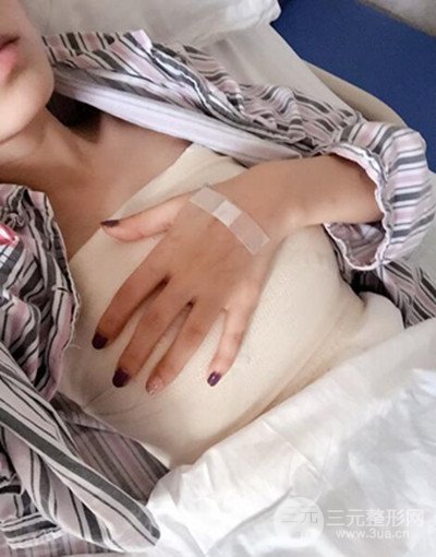 假体隆胸手术恢复记录，丰满大胸不是梦