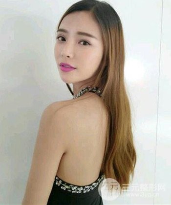 模特做隆鼻整形真实日记分享，附上恢复过程图