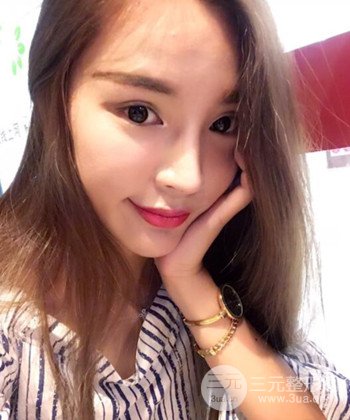 模特做隆鼻整形真实日记分享，附上恢复过程图