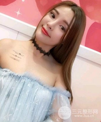 模特做隆鼻整形真实日记分享，附上恢复过程图