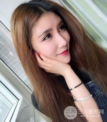 网络主播做自体脂肪丰太阳穴真实案例分享，果杠杠的