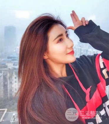 网络主播做自体脂肪丰太阳穴真实案例分享，果杠杠的