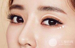 什么是韩式微创双眼皮？