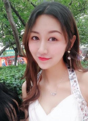 广州隆鼻整形真实恢复期图片，拥有精致美鼻不是梦