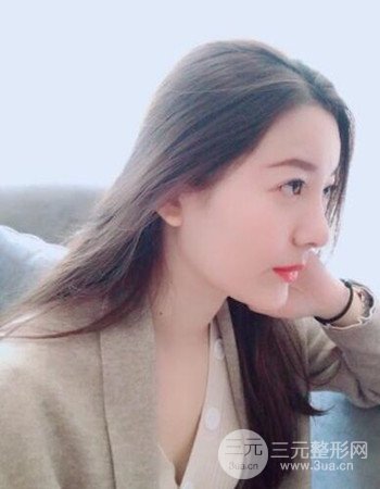 广州隆鼻整形+全脸自体脂肪填充真人案例果分享