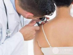 去痣的价格，激光点痣多少钱