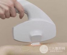 激光脱毛之后还会长吗？脱毛之后会反弹吗？