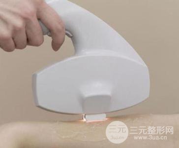 激光脱毛之后还会长吗？脱毛之后会反弹吗？