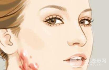 去除手术疤痕方法有哪些？