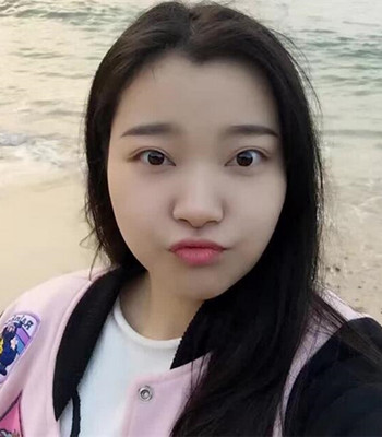 上海王艳隆鼻整形手术记录分享，果对比图分享