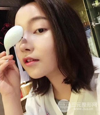 上海王艳隆鼻整形手术记录分享，果对比图分享