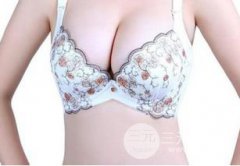 副乳吸脂休息多久恢复 要注意什么？