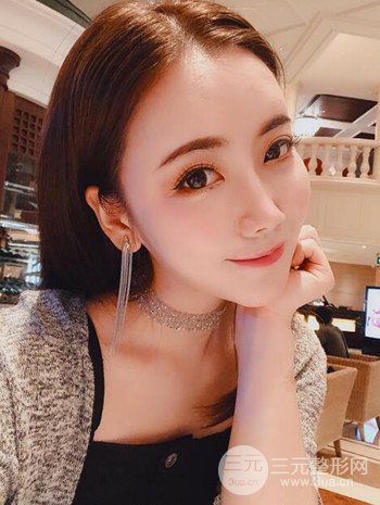 主播在深圳美臣做了自体脂肪全脸填充手术日记分享
