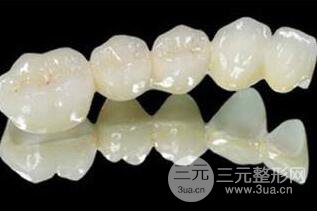 美容冠修复,价格