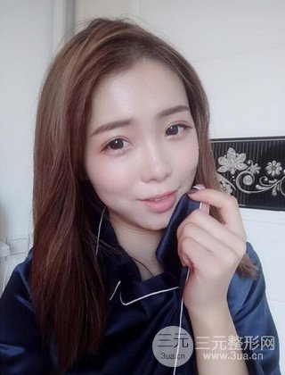 在上海诺诗做了自体脂肪填充全脸真人案例大曝光