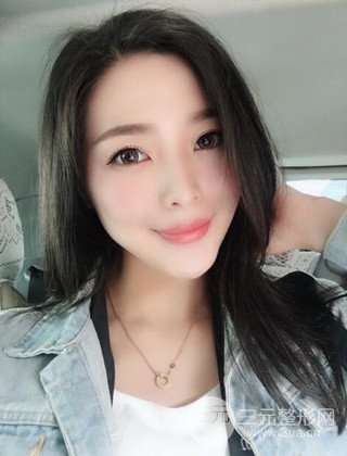 面部吸脂瘦脸手术日记分享，瘦脸果惊人