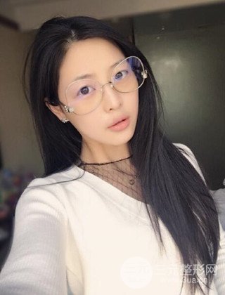 面部吸脂瘦脸手术日记分享，瘦脸果惊人