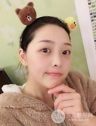 面部吸脂瘦脸手术日记分享，瘦脸果惊人