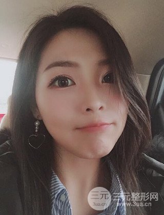 面部吸脂瘦脸手术日记分享，瘦脸果惊人